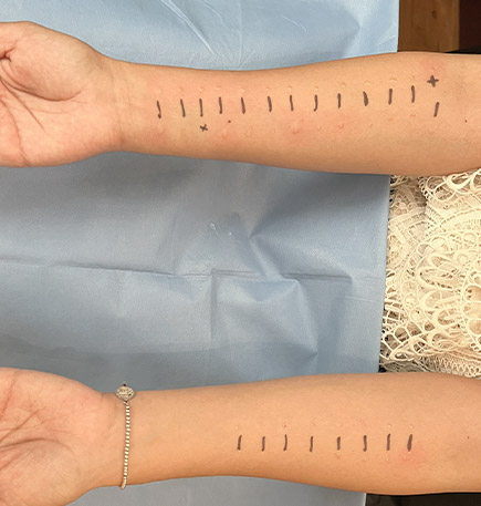 Dra Nancy Cruz alergia